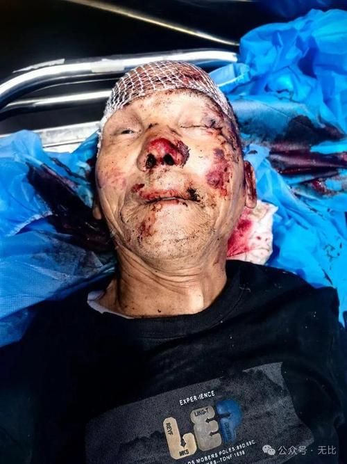 【山西省大同市广灵县新增17例死亡病例,涉及山东省济宁市梁山县,山西大同广灵老照片】
