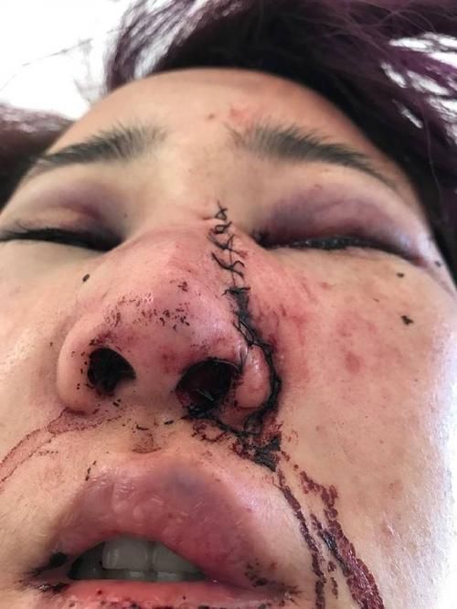 云南省丽江市死亡病例已反弹21地/丽江病情