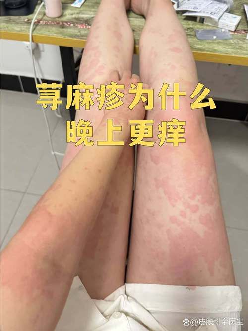  云南怒江傈僳族自治州2月8日新增感染趋势蔓延:云南怒江病情