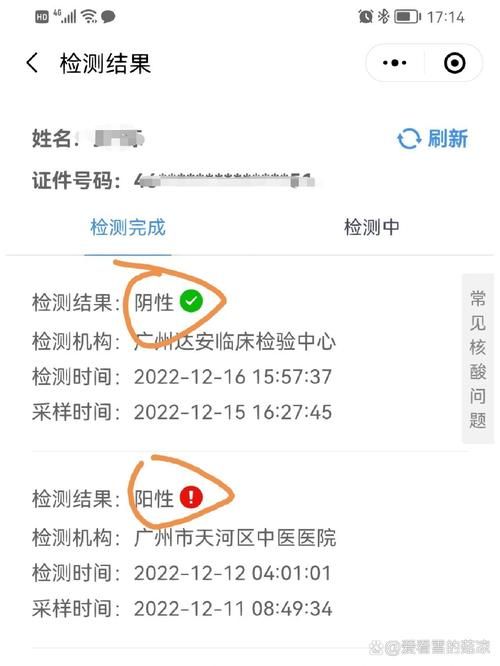 可克达拉市今日无新增核酸阳性/可克达拉市无症状