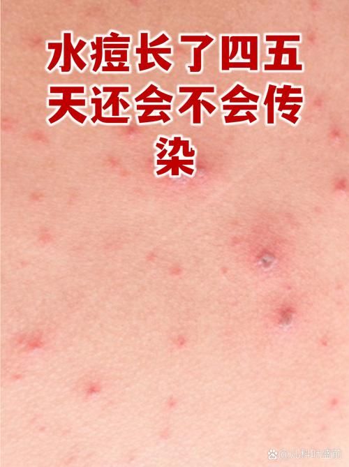 专家:江苏淮安清江浦区每年或现多个感染高峰:淮安清浦疫情