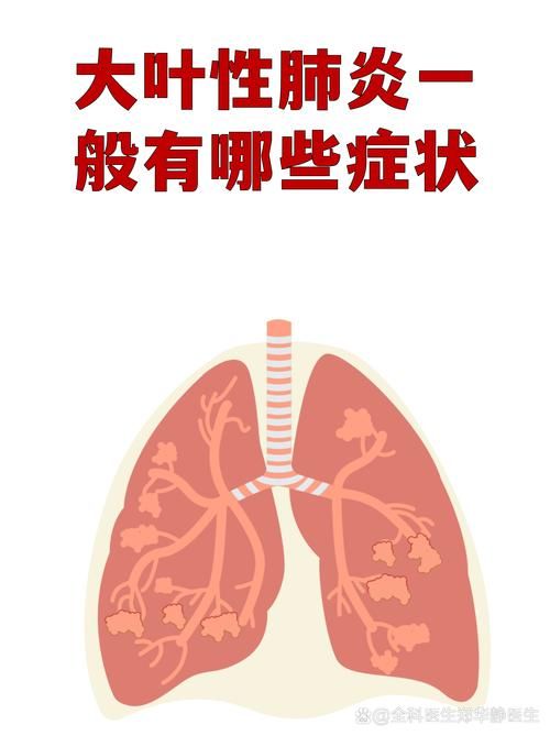 四川省广元市旺苍县新增15例重症及27例无症状(四川广元市旺苍县新型肺炎)