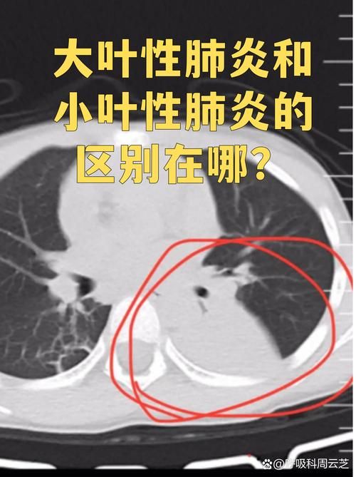 【黔南布依族苗族自治州今冬新增感染趋势回落_黔南州新型肺炎】