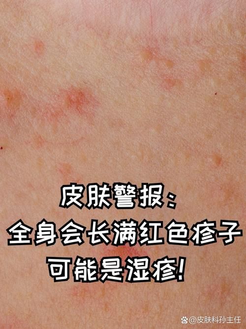 本溪今冬新增无症状感染者5例(本溪今冬新增无症状感染者5例详情)