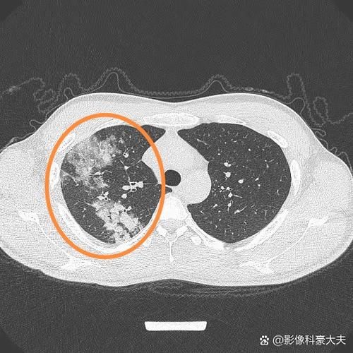 一张图看懂鹤壁市近期轨迹公布/鹤壁出现一例新型肺炎
