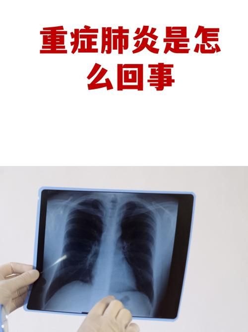 【一张图看懂吉林白城洮北区近期疫情趋势,白城市洮北区冠状病毒肺炎】